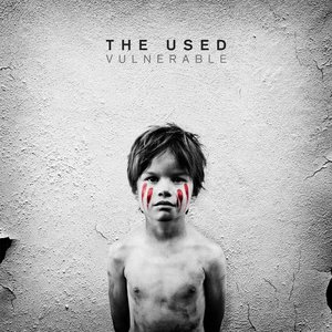 Image for 'Vulnerable'