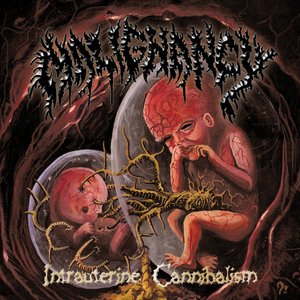 “Intrauterine Cannibalism”的封面