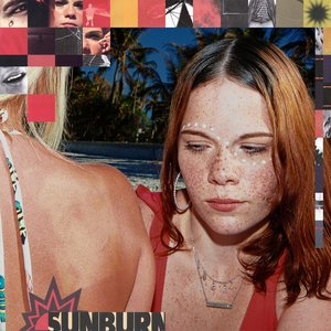 Immagine per 'Sunburn'