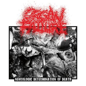 “Neurologic Determination of Death”的封面