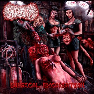 Imagen de 'Surgical Excoriation'