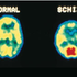 Avatar di schizophrenics