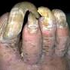 Аватар для toe_fungus